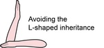 AVOIDING THE L-SHAPED INHERITANCE