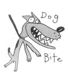 DOG BITE